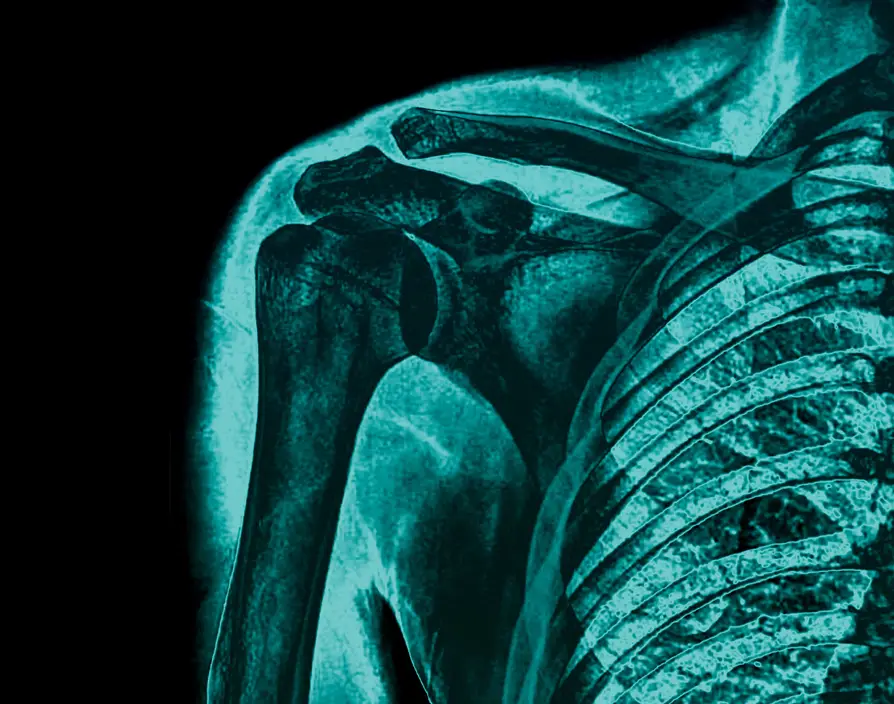 Are we silently destroying the backbone of the workplace?