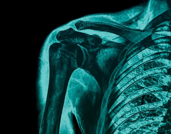 Are we silently destroying the backbone of the workplace?